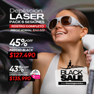 Depilación Láser Rostro Completo 6 ses.