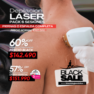 Depilación Láser Piernas o Espalda Completa 6 ses.